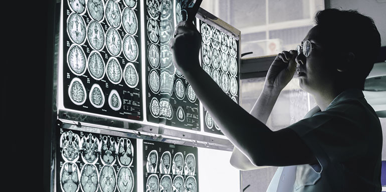 neurologist looking at brain imaging
