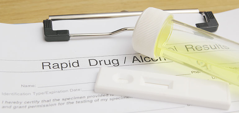 Drug testing form with urine sample