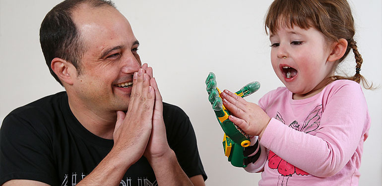 Mat Bowtell with child trying prosthetic hand