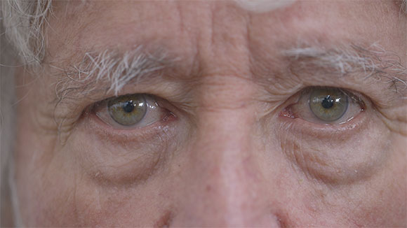 close up of Michael Leunig's eyes